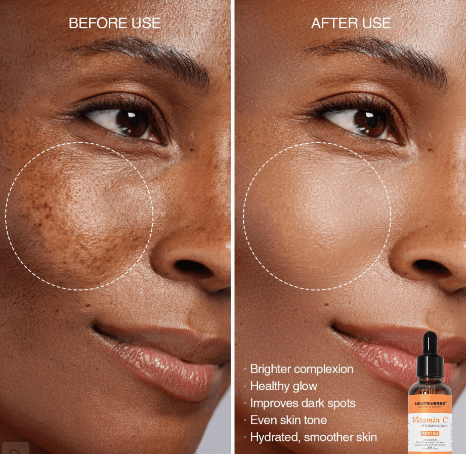 Vitamin C Serum - Image 4